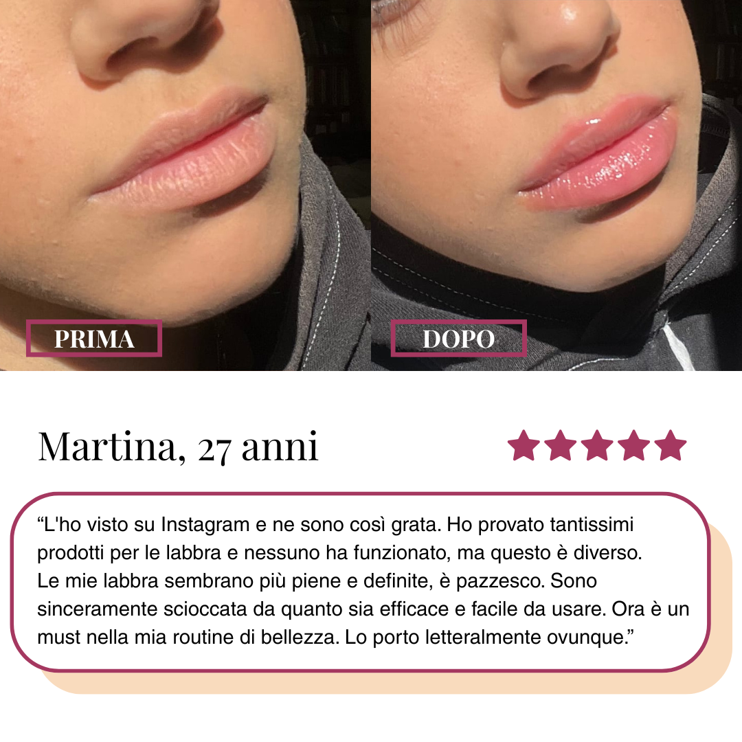 LippyUp® - Volumizzante Labbra